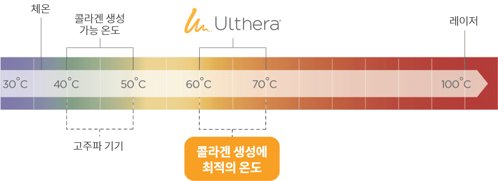 체온, 콜라겐 생성 가능 온도, 레이저, 고주파 기기 콜라겐 생성에 최적의 온도